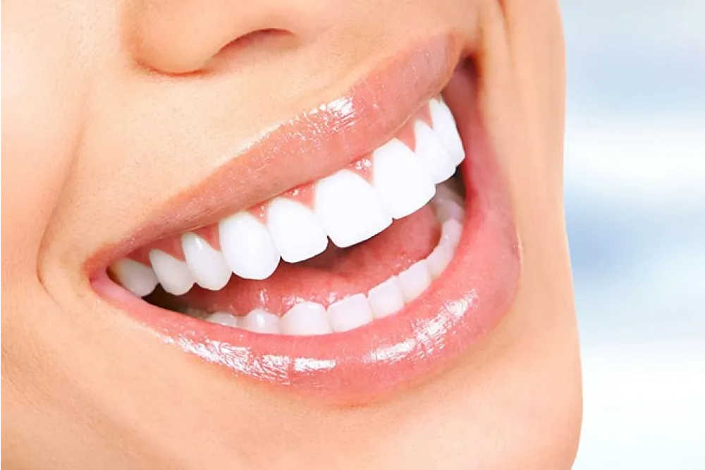 Lente de resina em Betim